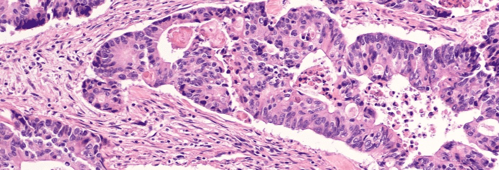 Histology image of colon cells